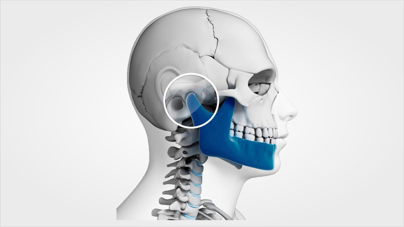 Curso Básico de Artroscopia da ATM - Dr. Fábio Sato